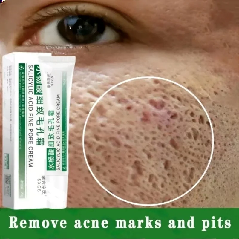 Salicylic Acid Blackhead Remover - Crème de nettoyage des pores à