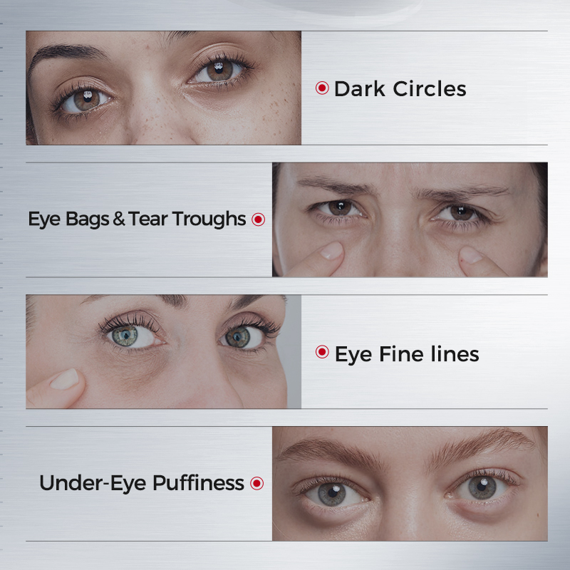 Patchs pour les yeux contre le - Collagen Under Eye Patches avis et prix