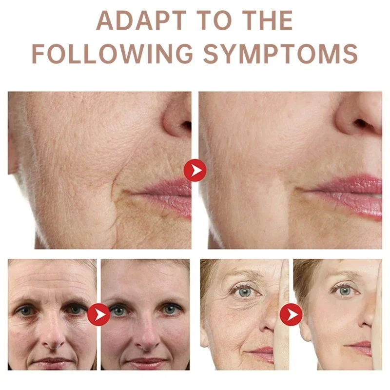 Crème anti-rides au rétinol po - Retinol Anti Wrinkle Cream avis et prix