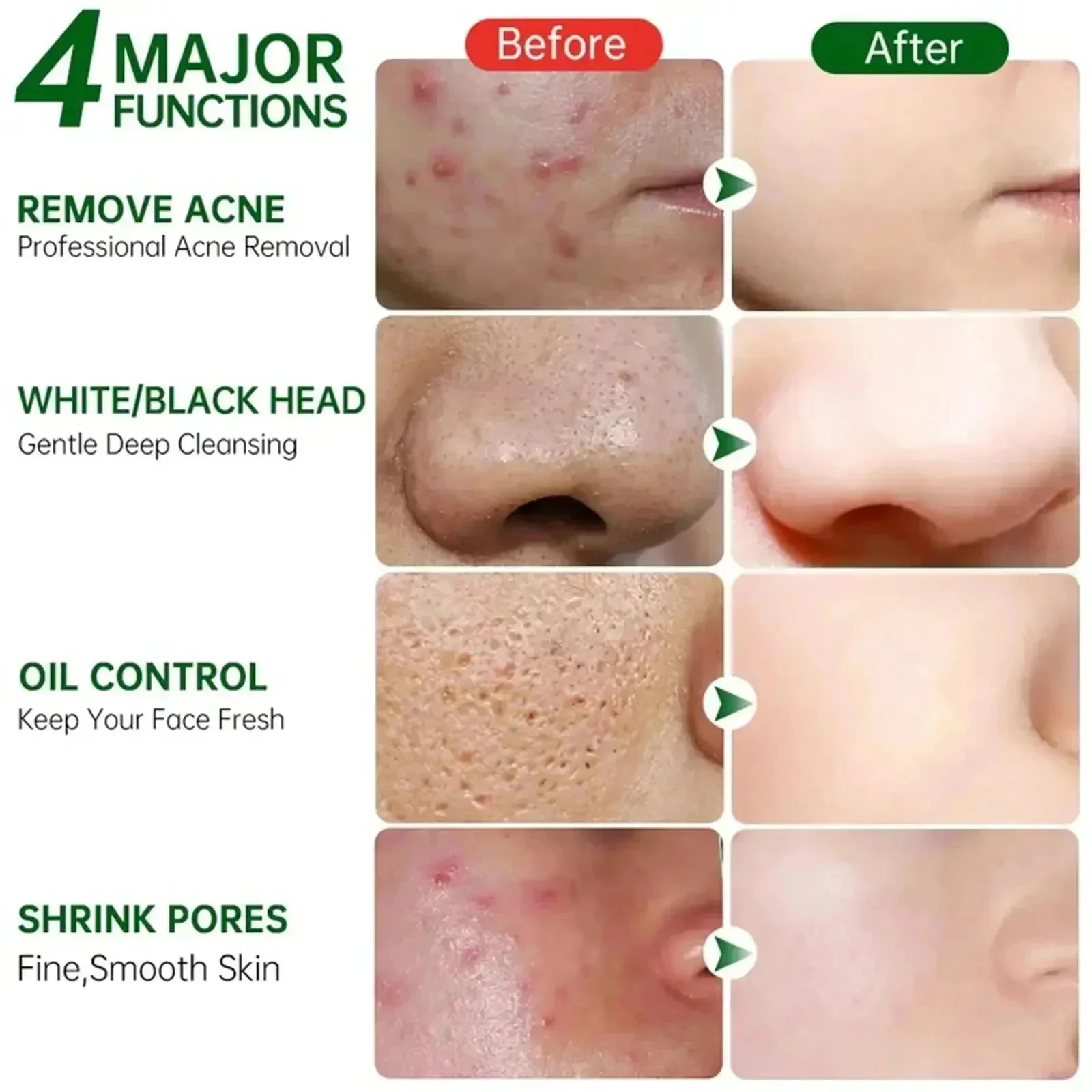 Crème de nettoyage des pores à - Salicylic Acid Blackhead Remover avis et prix
