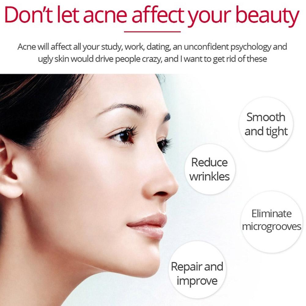 Crème raffermissante liftante  - Retinol Anti Wrinkle Cream avis et prix